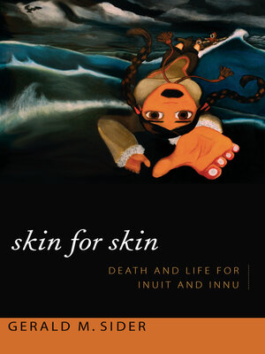 cover image of Skin for Skin